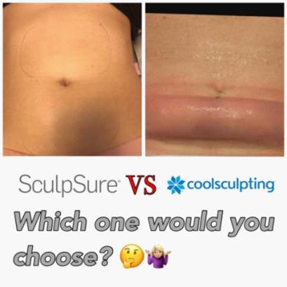 SculpSure vs. Liposuction: Choosing the Right Body Contouring